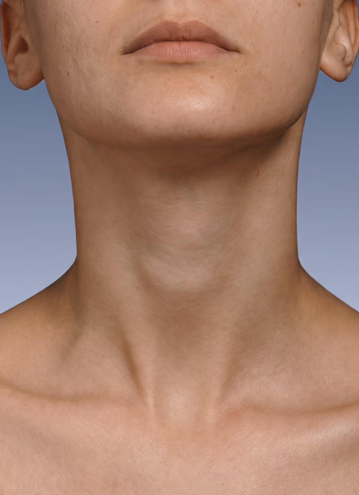 Before: the neck with fine lines and a crepey texture